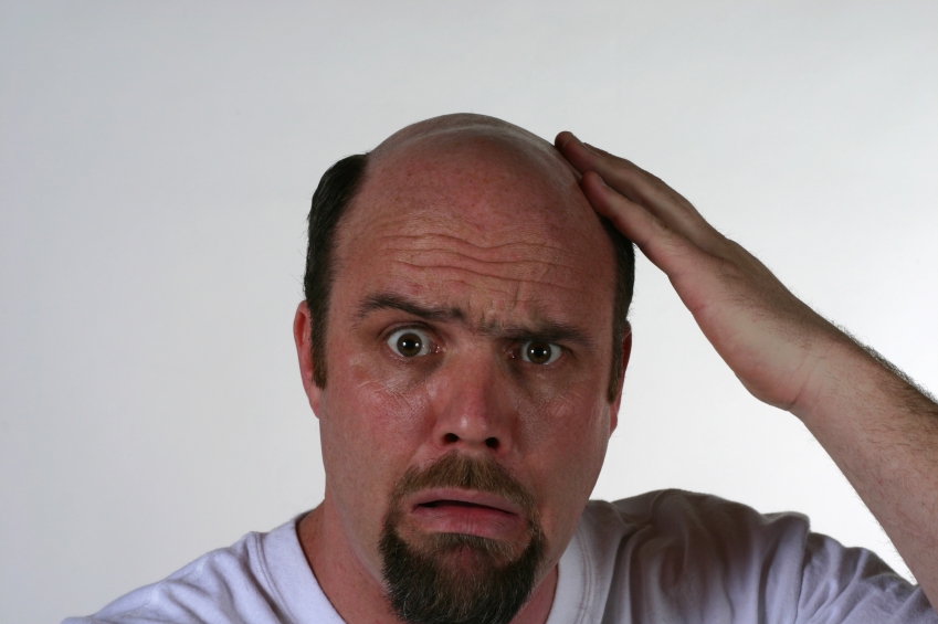 Treatment Of Hairfall Reason Of Hair Loss