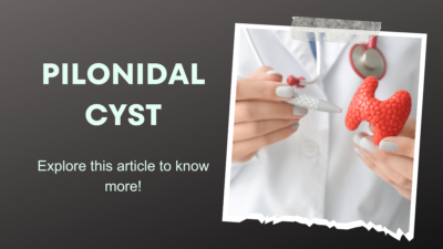 pilonidal cyst