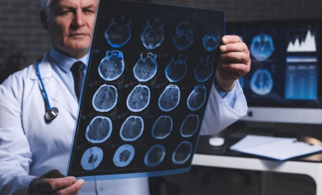 MRI scan open