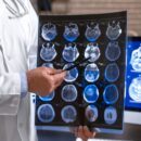 imaging center Glendale CA