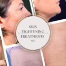 Skin Tightening