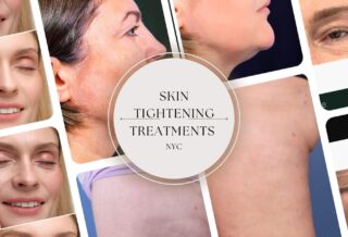Skin Tightening