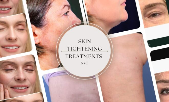 Skin Tightening